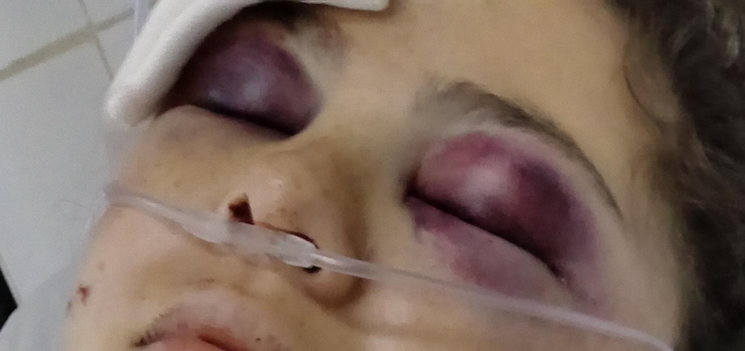 Misterio y preocupación: una joven universitaria fue hallada gravemente herida en una avenida de Concordia y buscan testigos - 7PAGINAS